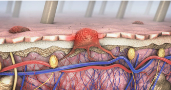 Image credit: Christoph Burgstedt - stock.adobe.com