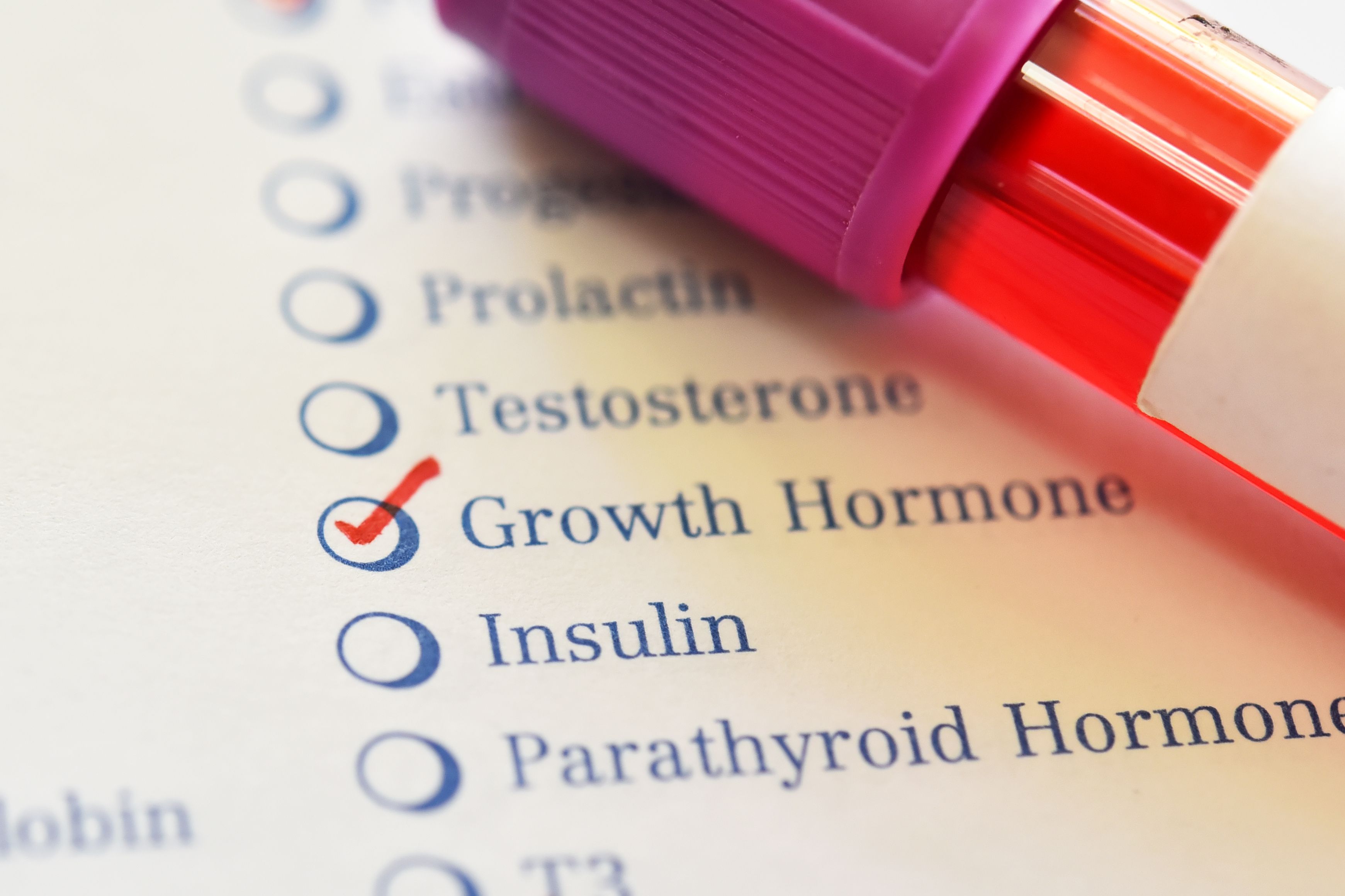 Blood sample tube with laboratory requisition form for growth hormone test - Image credit: jarun011 | stock.adobe.com