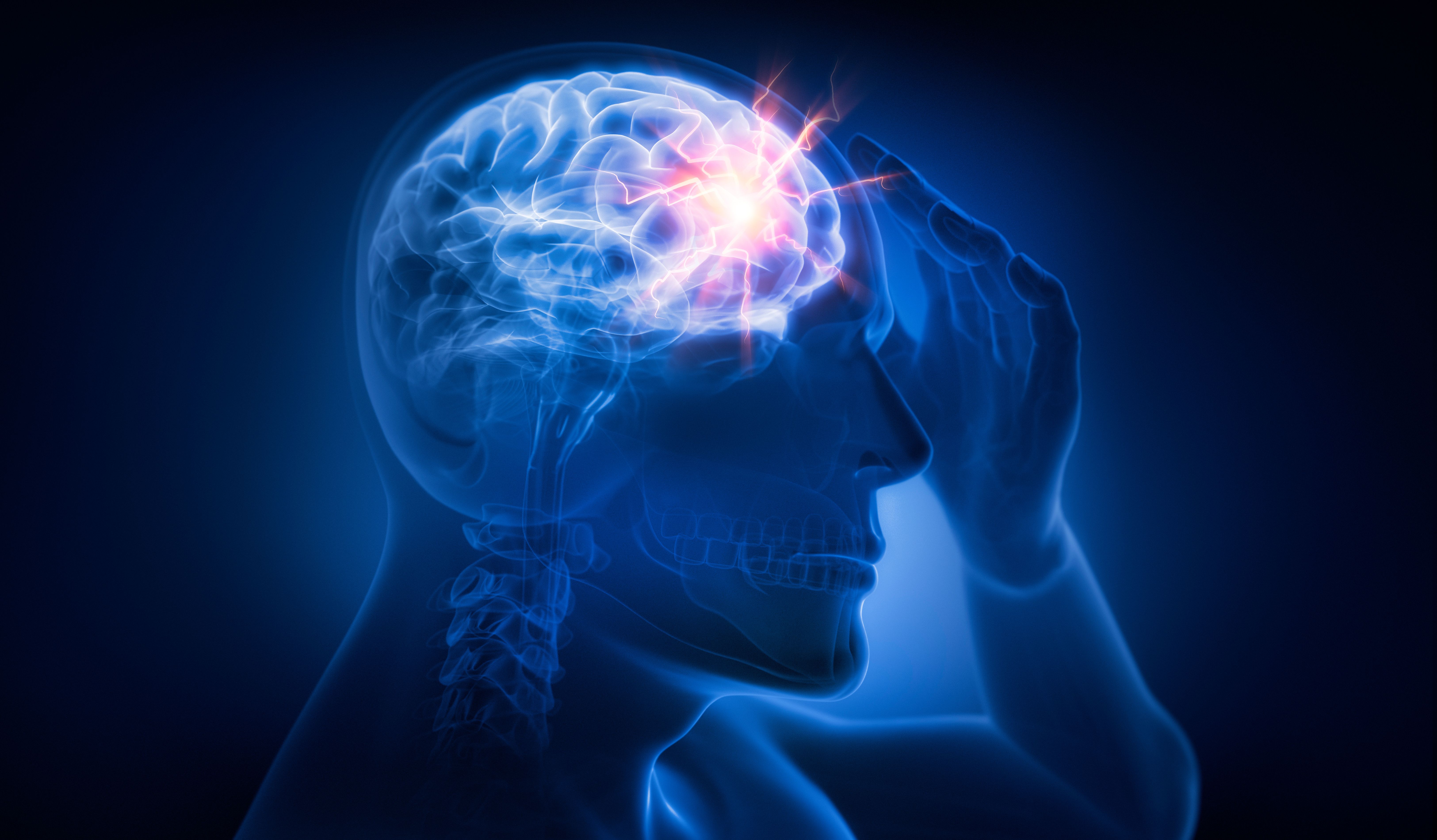 Man with heavy headache - 3D illustration - Image credit: peterschreiber.media | stock.adobe.com