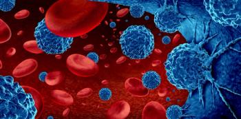Lymphoma, Rituximab, Biosimilar, Hematology | Image Credit: ©freshidea | stock.adobe.com
