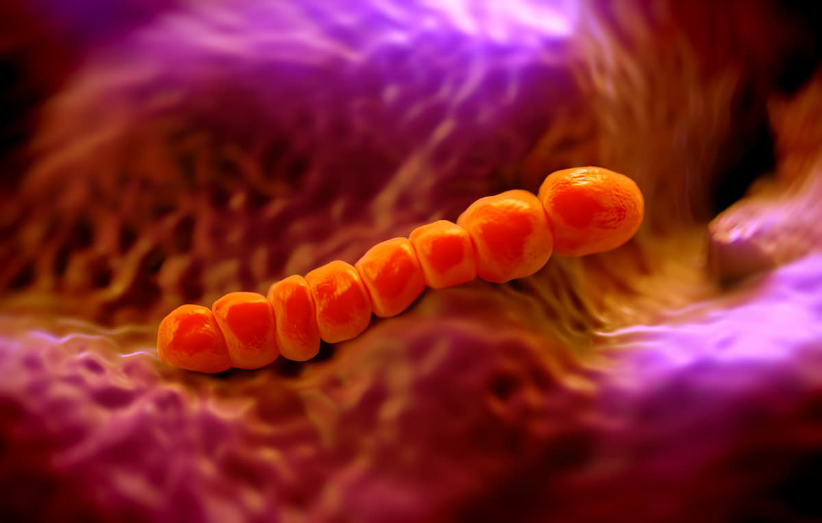 Streptococcus pneumoniae, or pneumococcus