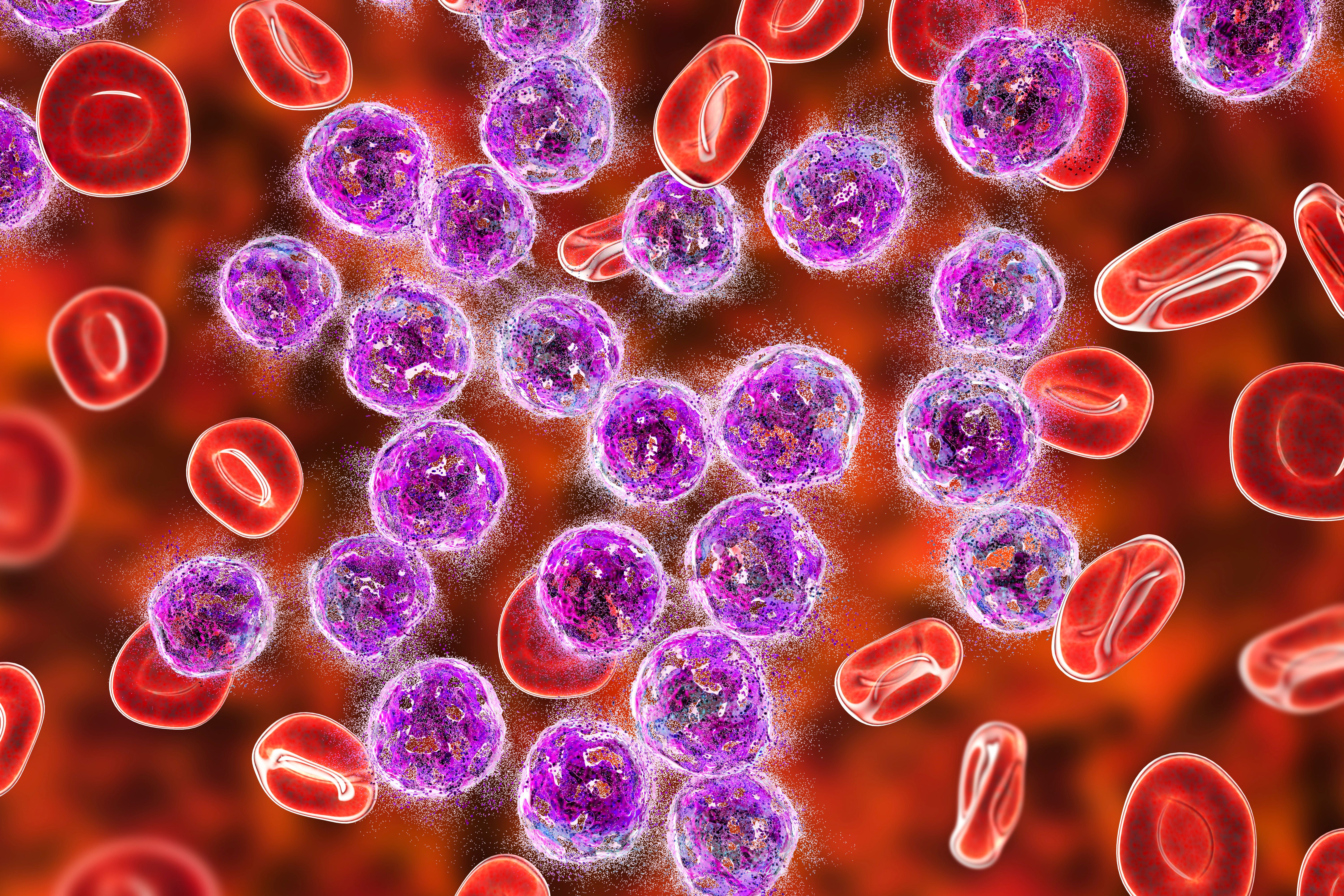 Destruction of lymphoblasts. Conceptual 3D illustration of treatment of acute lymphoblastic leukemia - Image credit: Dr_Microbe | stock.adobe.com