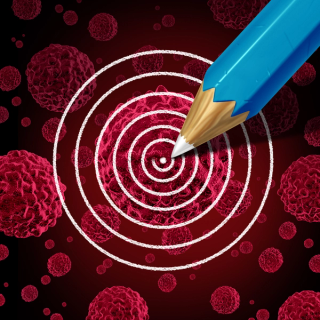 Importance of Expedited FDA Approval Process of Infigratinib for Treatment of Locally Advanced or Metastatic Cholangiocarcinoma
