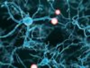 Achieving Disease Free Status in Multiple Sclerosis