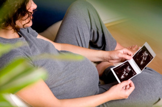 A Case of Pregnancy Despite Infertility From Congenital Plasminogen Deficiency