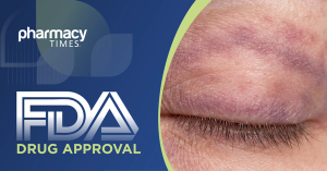 Dermatomyositis Macule (Heliotrope Rash) - - Macule in Human Skin — Medical Dermatology Plate (30-100)