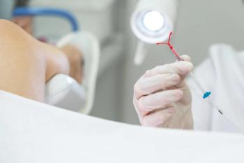 Health care professional preparing an IUD for insertion -- Image credit: Mariakray | stock.adobe.com