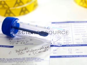 Optimize Clostridiodides difficile Tests and Diagnosis