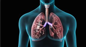 The Role of Tyrosine Kinase Inhibitors in Non–small Cell Lung Cancer