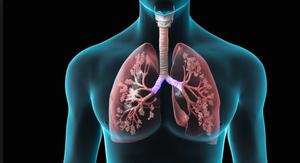 The Role of Tyrosine Kinase Inhibitors in Non–small Cell Lung Cancer