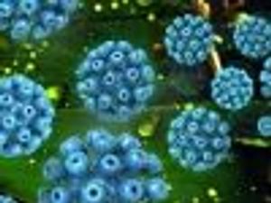 Sofosbuvir Achieves Sustained Virologic Response in HCV Patients With Cirrhosis