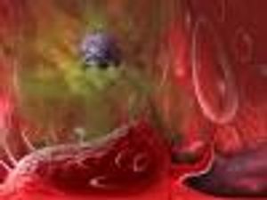 Relapsed Hodgkin Lymphoma Combination Shows Promise