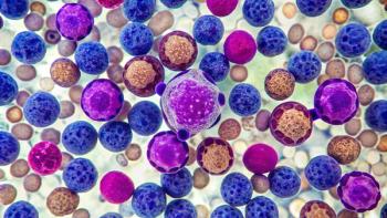 Microscopic view of mantle cell lymphoma | Image Credit: © Man888 - stock.adobe.com