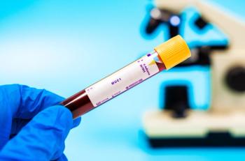 Blood sample vial testing MUC1 levels | Image Credit: © luchschenF - stock.adobe.com