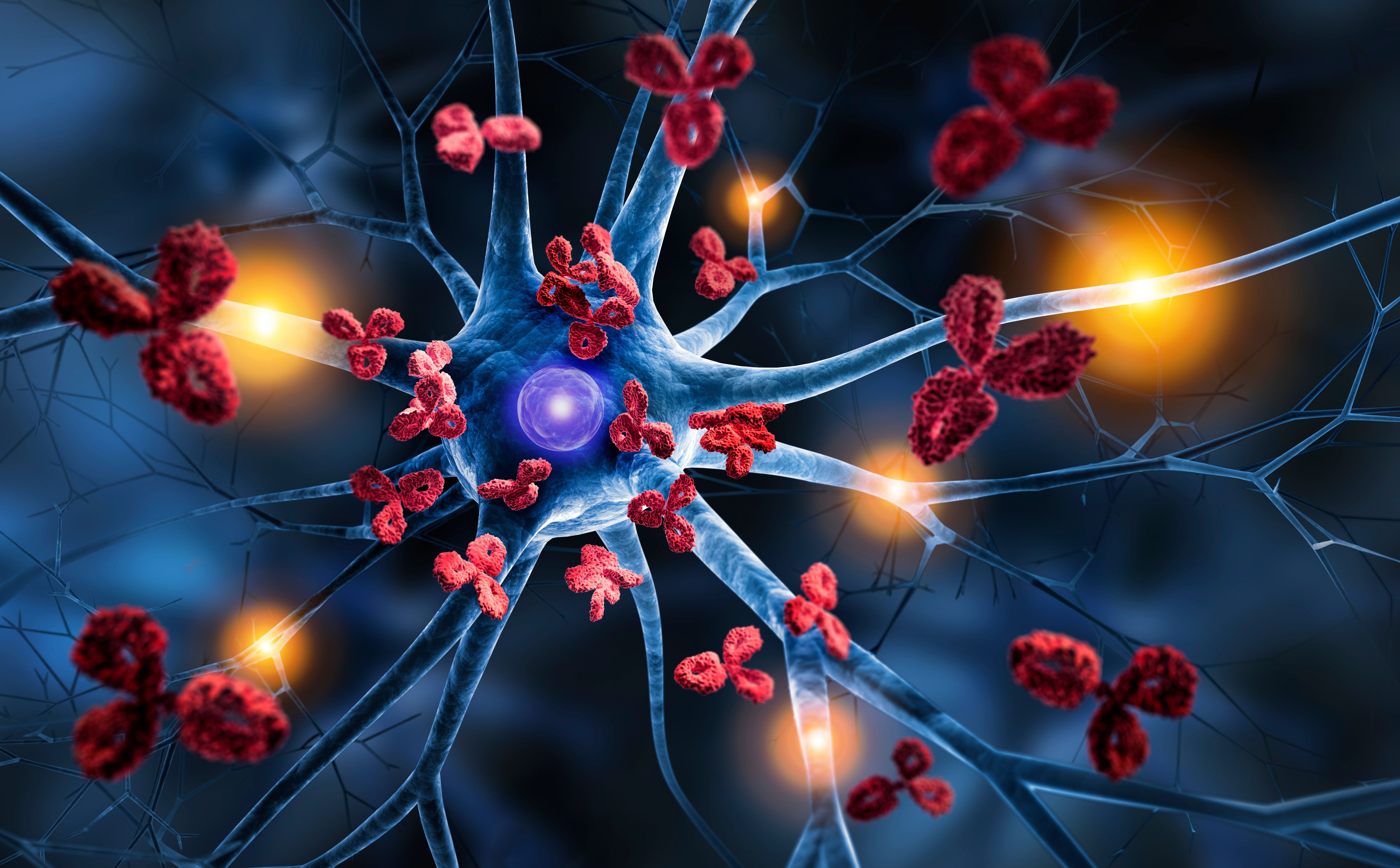 Alzheimer disease, amyloid plaque | Image Credit: peterschreiber.media - stock.adobe.com