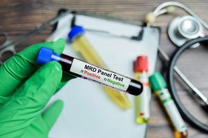 MRD blood test | Image Credit: © syahrir - stock.adobe.com