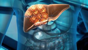Armored CAR T-Cell Therapy Produces Durable Complete Response in Pediatric Solid Tumors