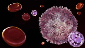 3d rendering of Hairy cell leukemia (HCL) is a rare type of chronic leukemia that develops slowly from white blood cells called B lymphocytes. | Image Credit: Love Employee | stock.adobe.com