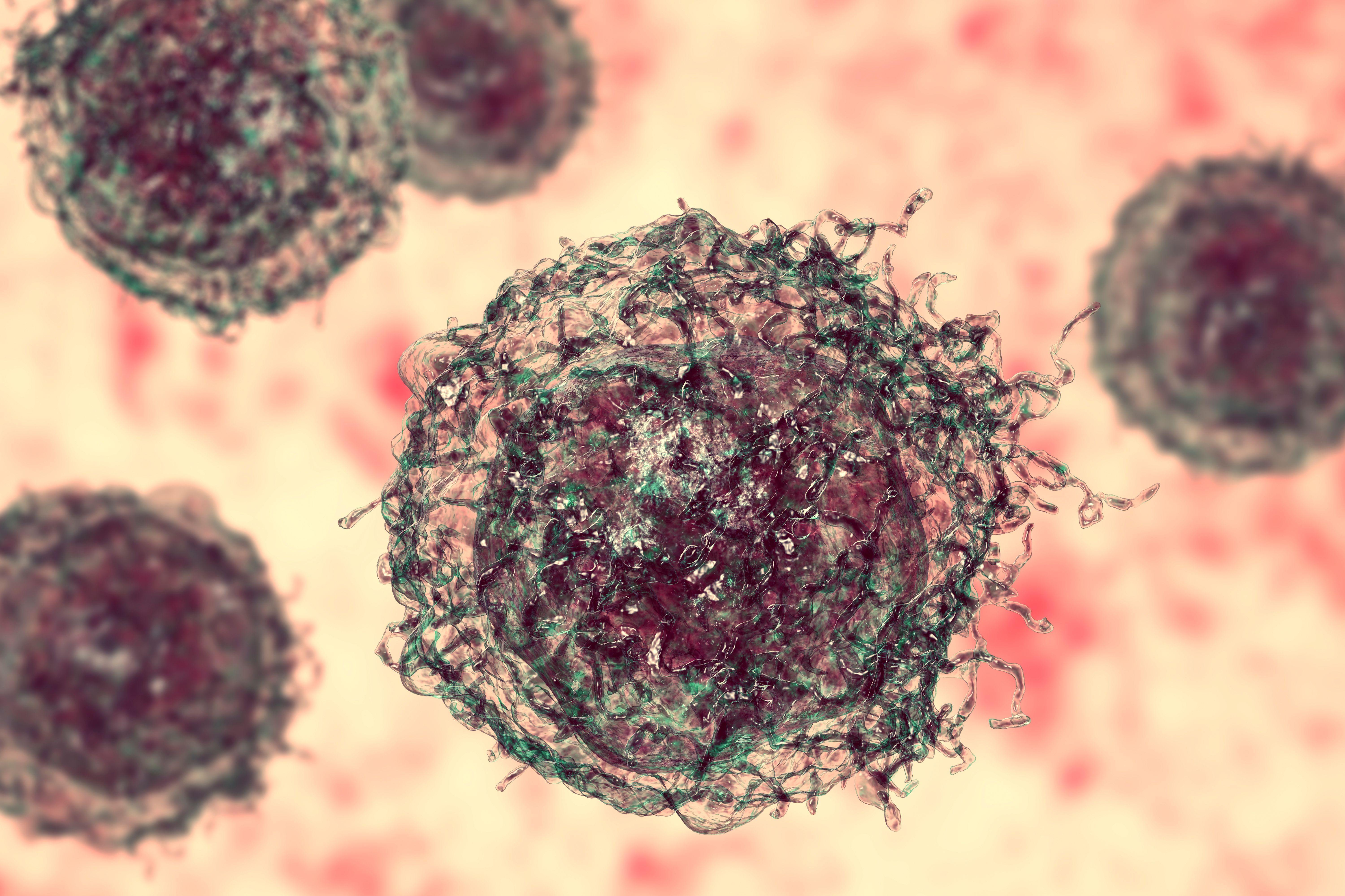 Phase 3 Results Show First-Line Amivantamab-vmjw Plus Chemotherapy Prolongs Survival In Patients With Advanced or Metastatic NSCLC