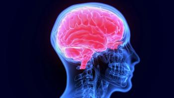 X-ray scan of brain -- Image credit: PIC4U | stock.adobe.com