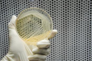 Hand in glove is holding a petri dish of cross streak of Saccharomyces cerevisiae (baker yeast) growing on yeast extract peptone dextrose agar plate. microbiology laboratory test - Image credit: theeraphop | stock.adobe.com