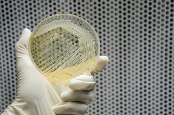 Hand in glove is holding a petri dish of cross streak of Saccharomyces cerevisiae (baker yeast) growing on yeast extract peptone dextrose agar plate. microbiology laboratory test - Image credit: theeraphop | stock.adobe.com