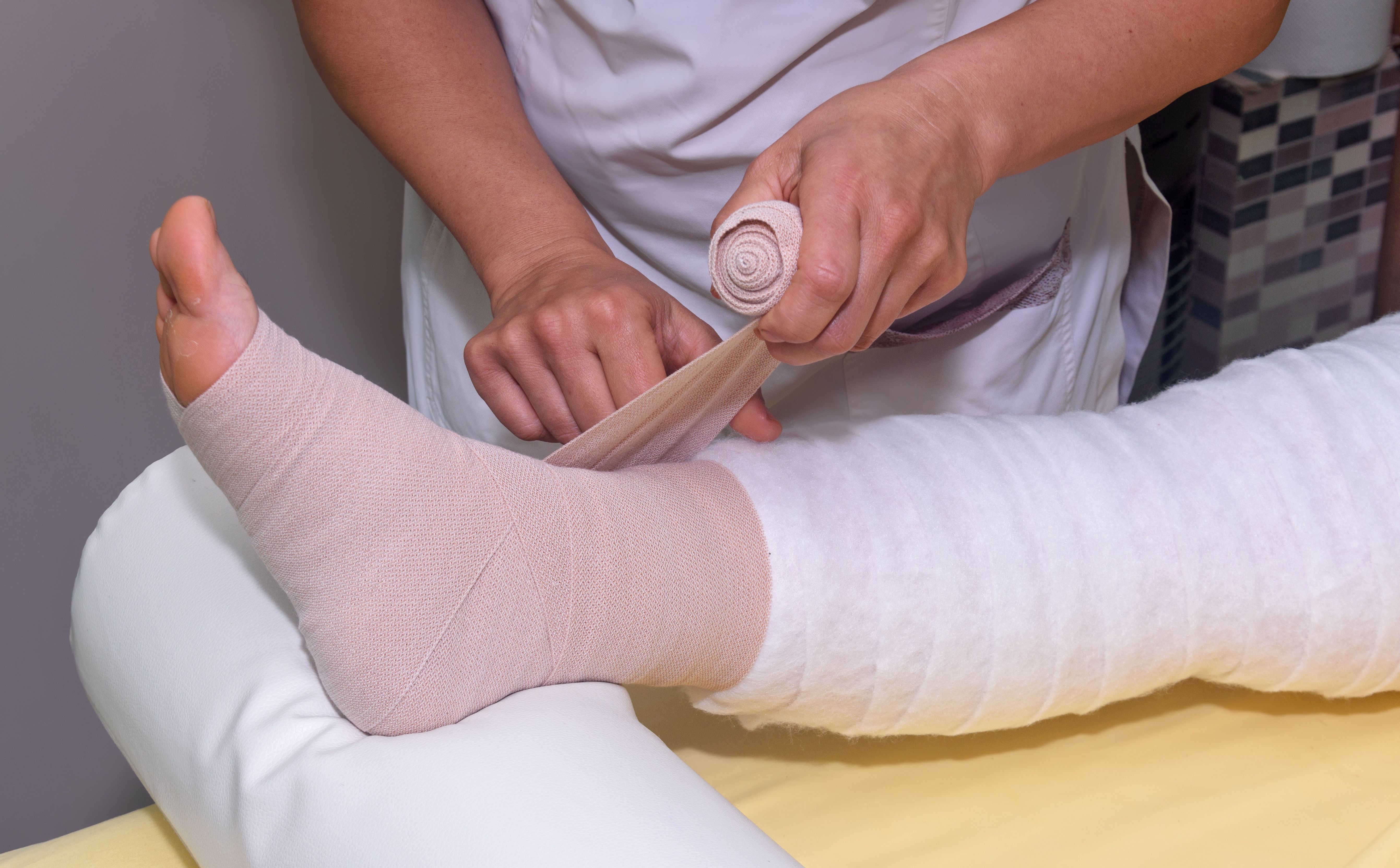 Patient with lymphedema in their leg