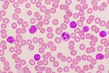 Blood under microscope showing CLL cells | Image Credit: © jarun011 - stock.adobe.com