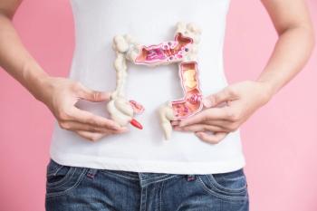 Woman holding model of colon -- Image credit: ryanking999 | stock.adobe.com