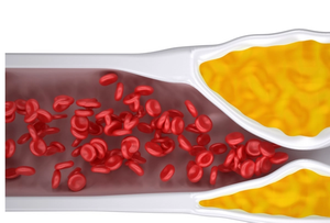 Repatha: A Lipid-lowering Monoclonal Antibody