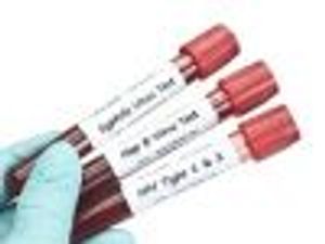 HCV Combo Effective Treating Patients With HIV Coinfection After Disease Recurrence