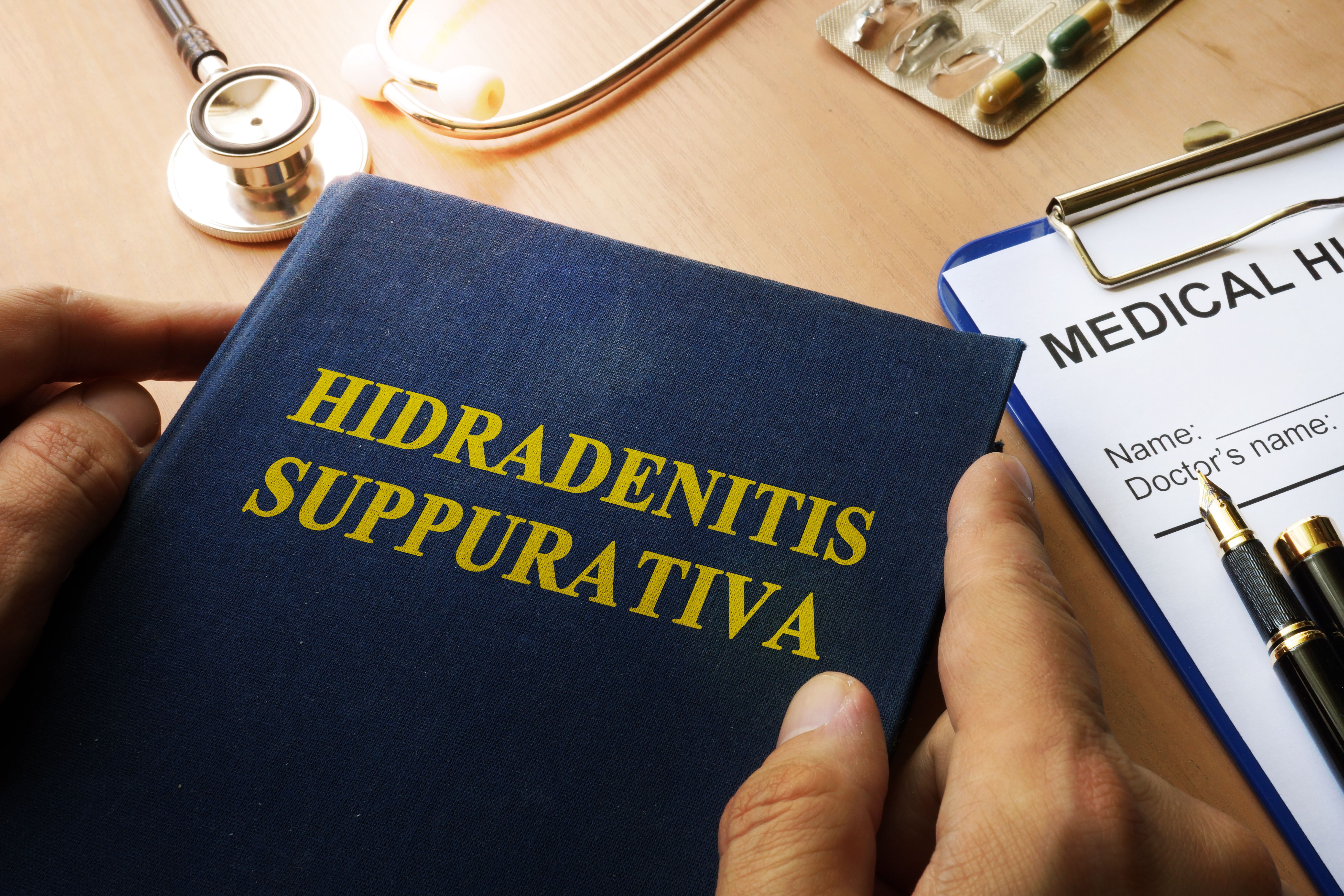 Book with title Hidradenitis Suppurativa on a table. | Image Credit: Vitalii Vodolazskyi | stock.adobe.com