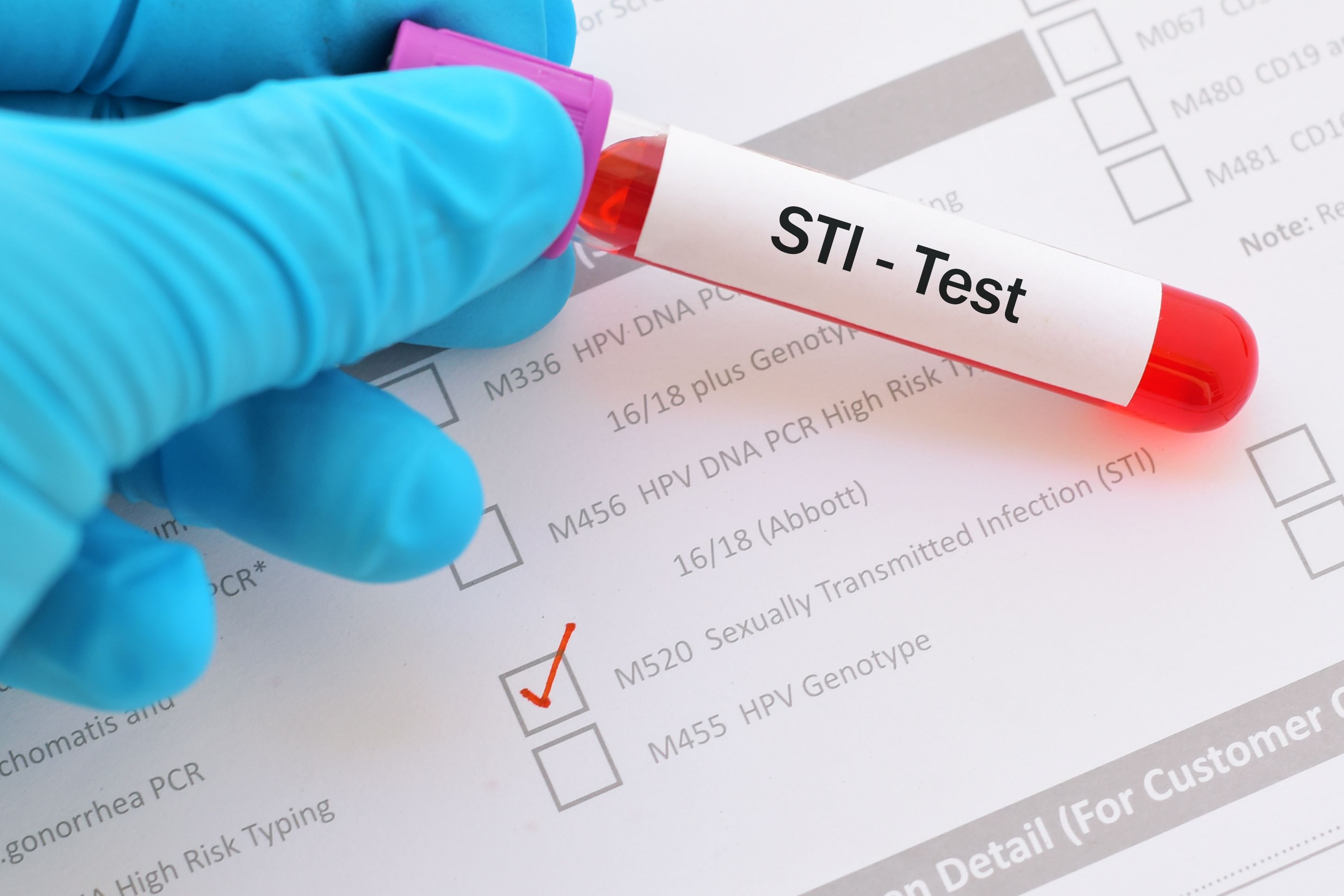 FDA Approves At-House Assortment Gadget to Check for Chlamydia and Gonorrhea FDA Approves At-House Assortment Gadget to Check for Chlamydia and Gonorrhea