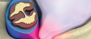 Pain Management: The Pharmacist's Evolving Role