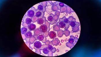 multiple myeloma plasma cell imaging under microscope | Image Credit: Erik | stock.adobe.com