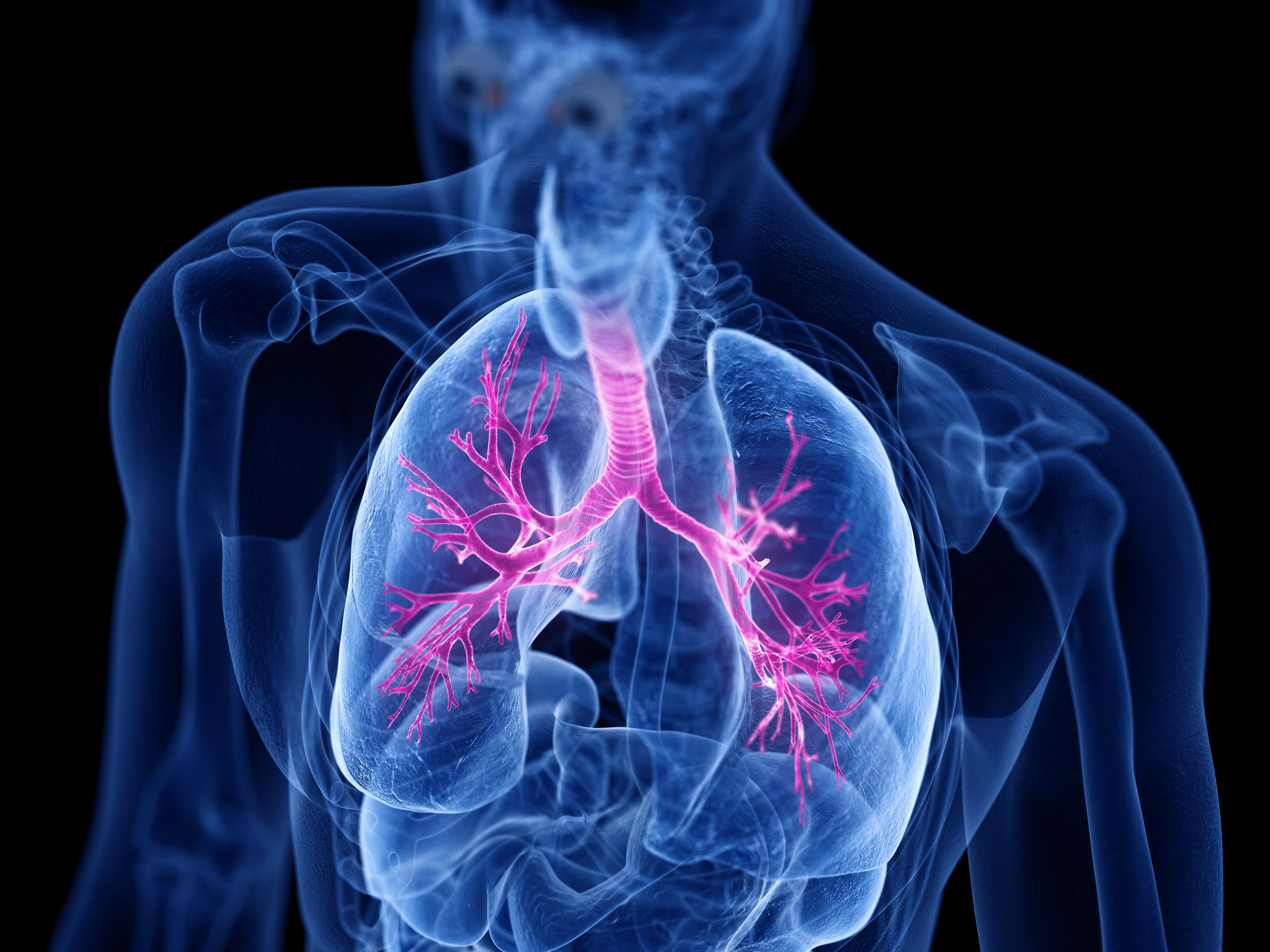 FDA Approves Expanded Use for Trikafta in Cystic Fibrosis