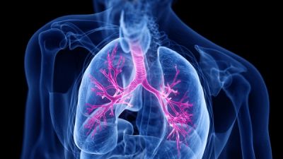 Lungs with asthma -- Image credit: Sebastian Kaulitzki | stock.adobe.com