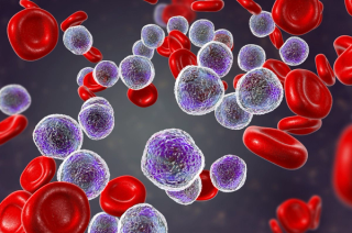 Pharmacist Medication Insights: Tecartus for Mantle Cell Lymphoma