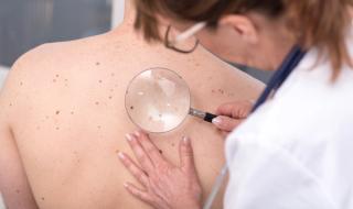 Dermatologist examining the skin of a patient | Image Credit: thodonal - stock.adobe.com