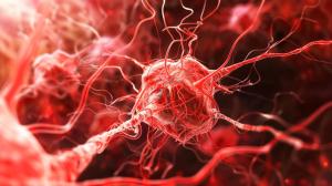 3D visualization of Hodgkin Lymphoma | Image Credit: © Thipphaphone - stock.adobe.com