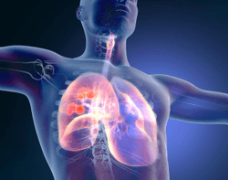 Novel Mechanisms of Action Open Door for New Drugs in Non–Small Cell Lung Cancer