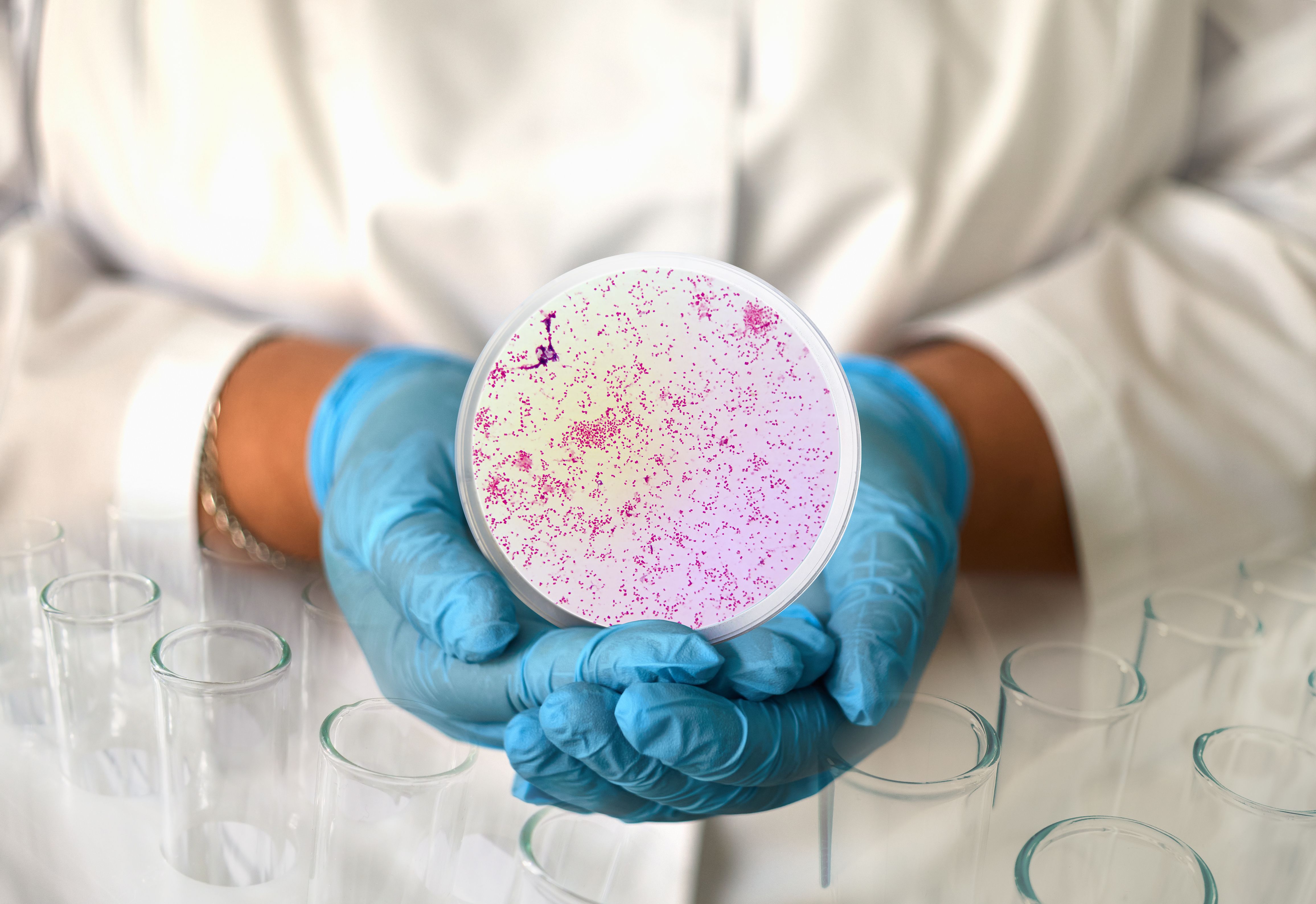 Petri dish with gonorrhea bacteria -- Image credit: Степан Хаджи | stock.adobe.com