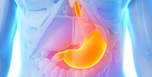GERD: When Medication Management Fails