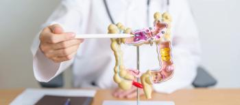 Doctor with colon model