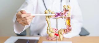 Doctor with colon model