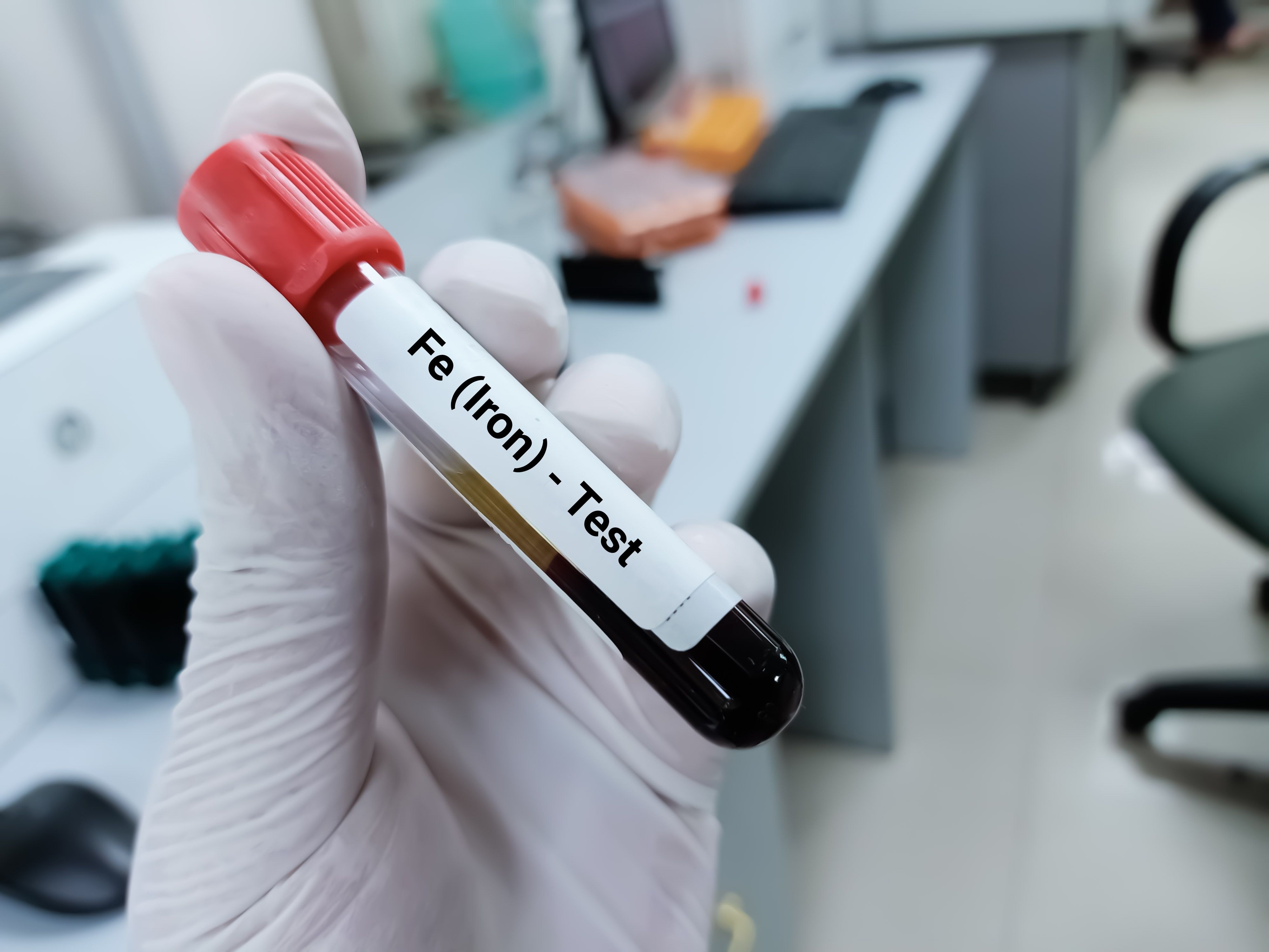 There Are Increasing Opportunities for Community Pharmacies to Help Patients With Anemia in Condition Management