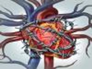 PCSK9 Inhibitor Gets Priority Review as Cardiovascular Risk Treatment
