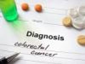 Combo Therapy Well-Tolerate in RAS Wild-Type Metastatic Colorectal Cancer