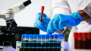 Emavusertib-Based Therapy Produces Responses in BTK Inhibitor–Treated Primary CNS Lymphoma