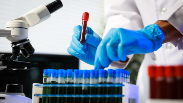 Emavusertib-Based Therapy Produces Responses in BTK Inhibitor–Treated Primary CNS Lymphoma